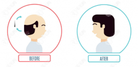 北海植发医院哪家好?韩美/中禾就是北海正规植发的好地方哦