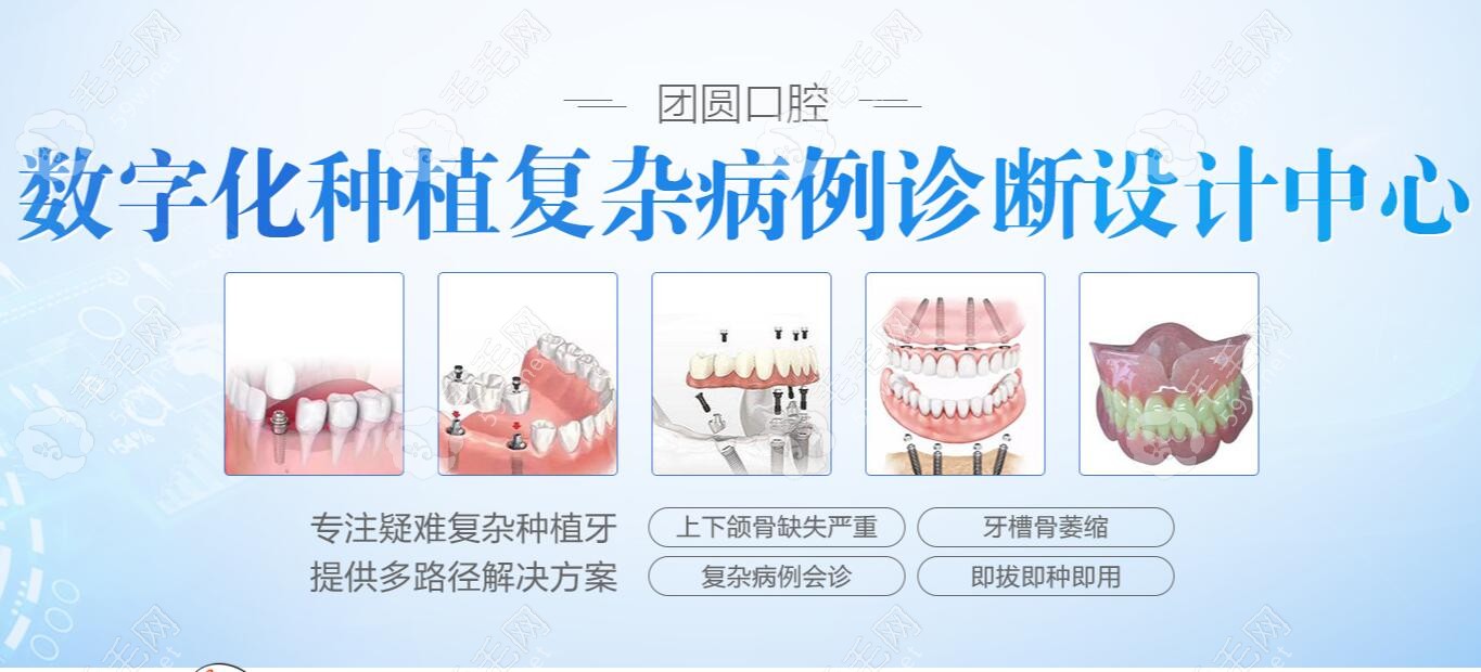 团圆内设数字化种植复杂病例诊断设计中心