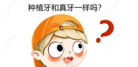 種植牙跟真牙一樣嗎?兩者外表相似但功能上有區(qū)別