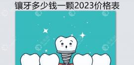 鑲牙多少錢一顆2025價(jià)格表:1顆種植牙5k+/1顆全瓷牙2k+/烤瓷牙..