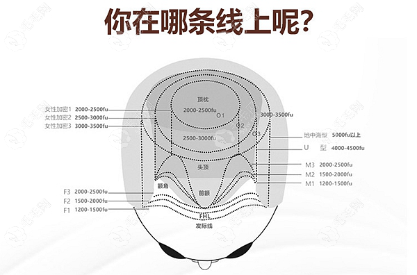 北京联合丽格植发多少钱 59w.net