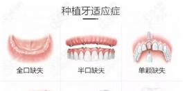 2025牙科收费价目表有调整,今年种植牙/牙齿矫正价格是这样