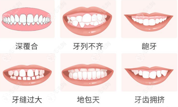 麦芽口腔做牙齿矫正怎么样 毛毛网