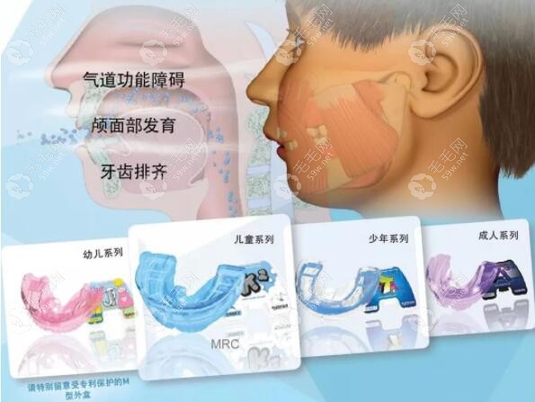 mrc肌功能矫正器示意图