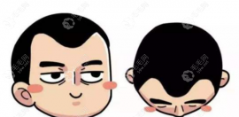 O型/C型/M型/M+O型/复合型这几种脱发类型形状图片大全