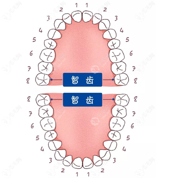 拔智齿多少钱一颗2023价格表 59w.net