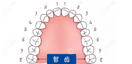 拔智齒牙多少錢一顆2025價格表:拔水平/埋伏/阻生智齒200-2000+