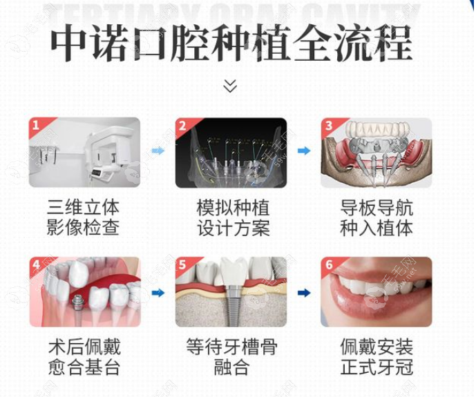 中诺口腔医院种植牙价格表 59w.net