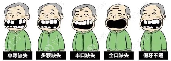 牙博士口腔医院种植牙价格表