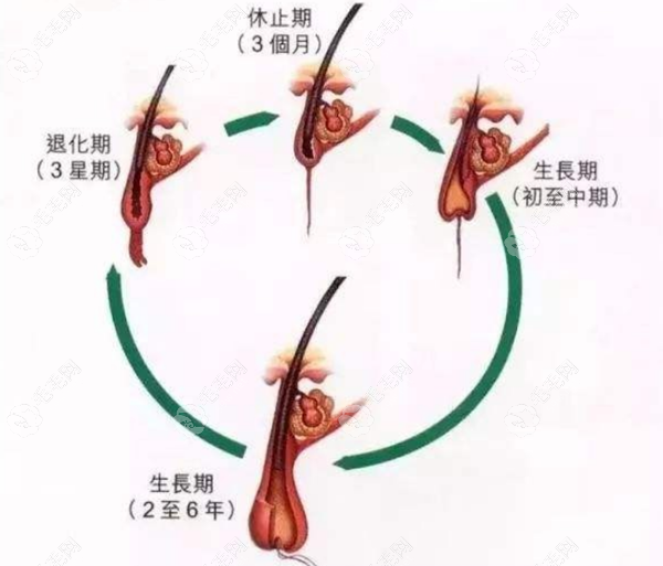 头发生长期退化起 毛毛网