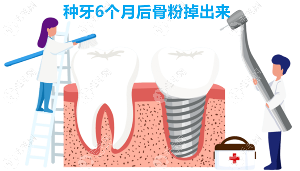 种牙6个月后骨粉掉出来不正常,瞧骨粉掉出来该怎么办咋处理