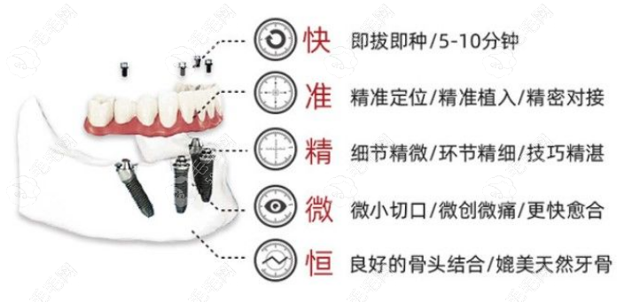 即刻负重种植牙只需1次开刀就可以