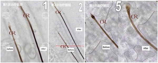 碧莲盛美丝沛生发价格及图示