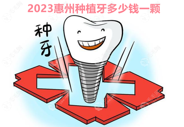 惠州种植牙多少钱一颗?2023年惠城区/惠阳区种植牙齿价格表