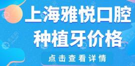 上海雅悦口腔种植牙多少钱?韩国种植牙4999/德国进口15800