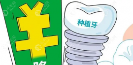 广东省种植牙降价政策:广州/佛山/东莞种牙集采价格下降55%