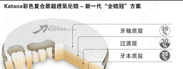 全瓷牙冠品牌种类及价格,进口/国产牙冠的价格及图片分享