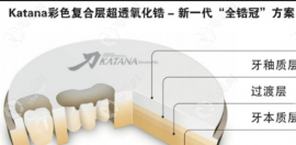 全瓷牙冠品牌种类及价格,进口/国产牙冠的价格及图片分享