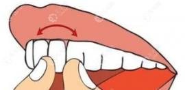成年以后千萬別整牙否則牙齒會(huì)松動(dòng)?真相是牙松動(dòng)后能恢復(fù)
