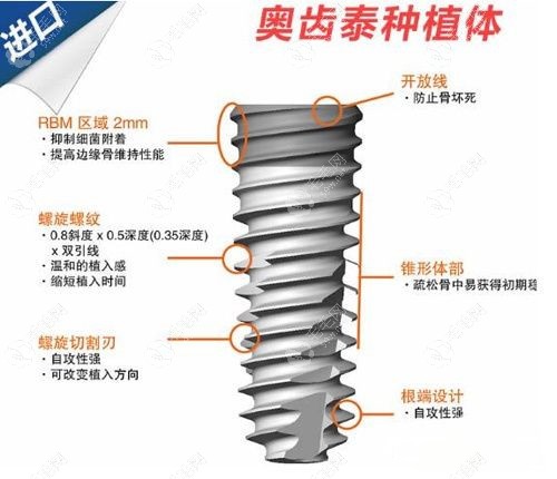 韩国奥齿泰种植牙成本多少钱