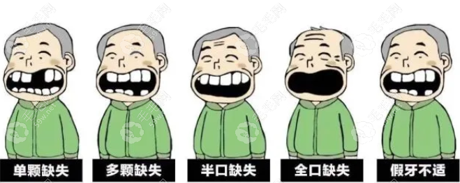 贵阳牙博士口腔医院种植超低价仅500多元1颗