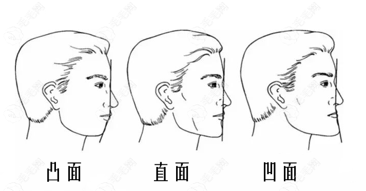 有些情况做掩饰性正畸没有用