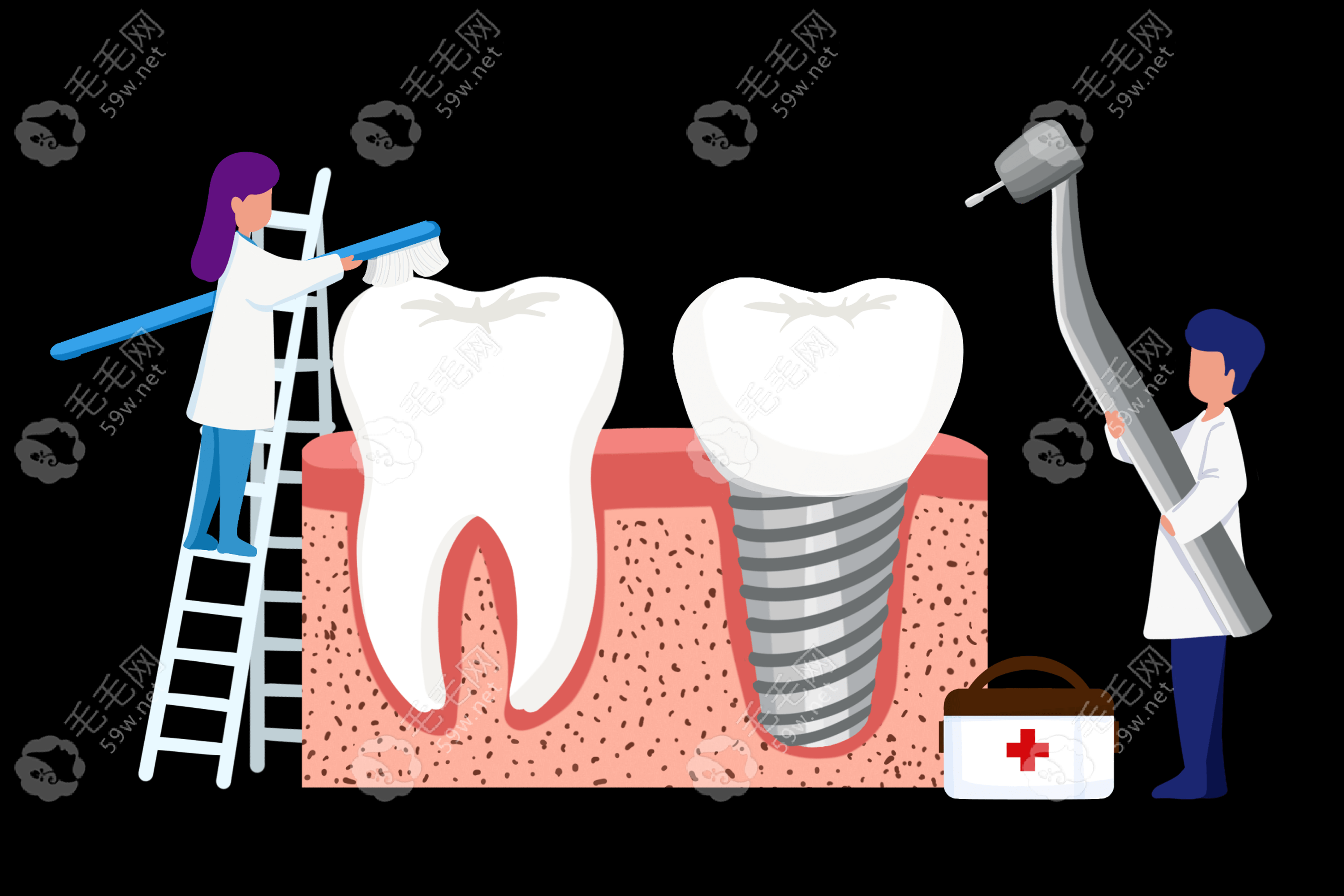 种植牙结构示意图www.59w.net