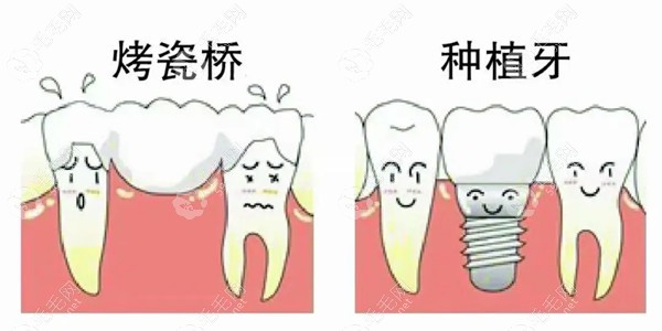 德韩口腔医院种植牙收费标准