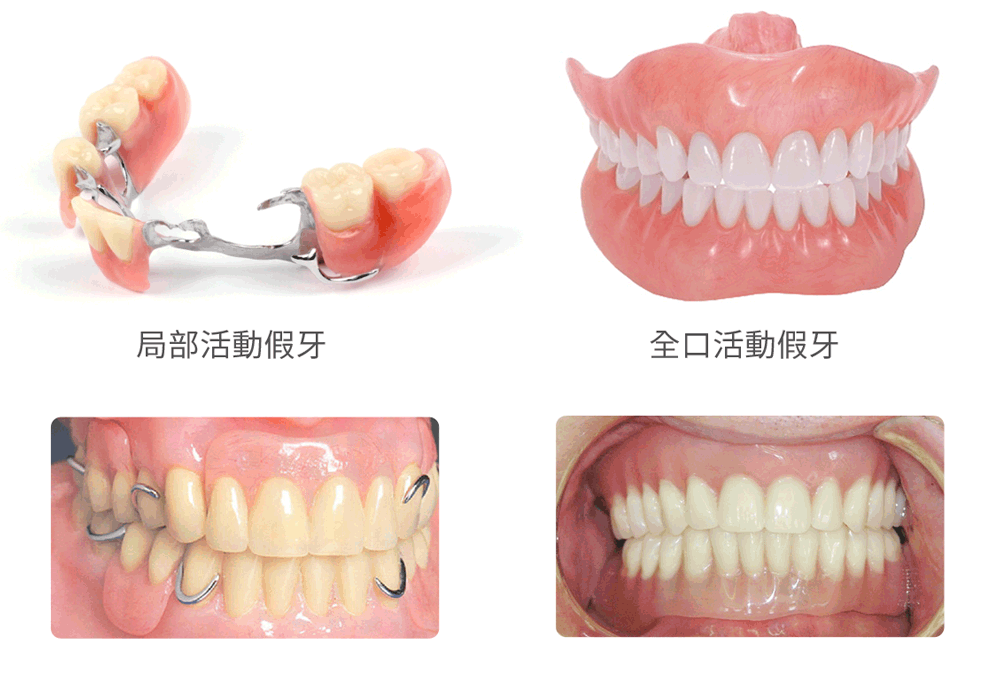 德韩口腔医院补牙价格