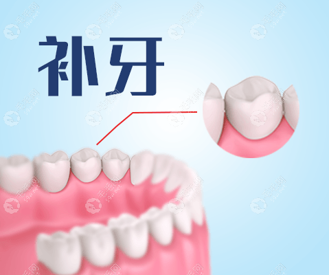 烟台口腔医院补牙收费标准：150-400元左右一颗