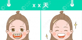 儿童早期矫正牙齿的意义有哪些?年龄小正畸很快费用还便宜
