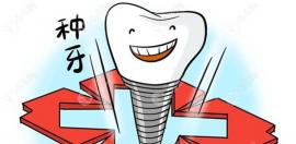 种植牙纳入集采是什么意思?种牙集采是指集中采购,统一价格
