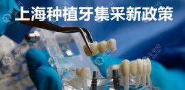 上海种植牙集采新政策出台:牙科种牙价格调整/泰康免费义诊