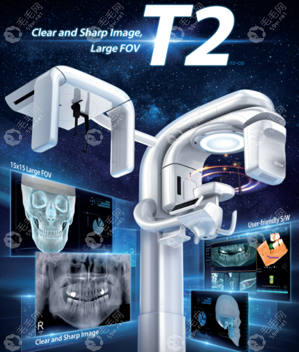 出种植牙专用CBCT"T2 设备