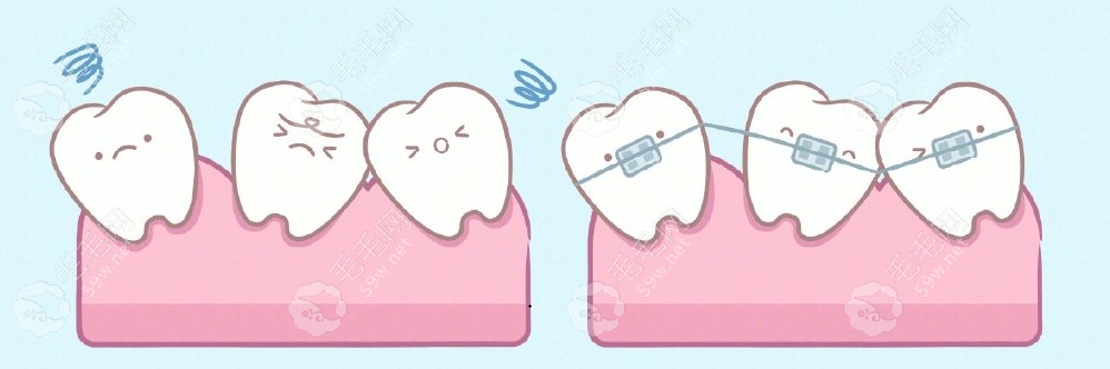 广州市德伦口腔正畸价格59w.net