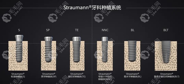 瑞士士卓曼种植体真伪查询方法:包装盒找型号/编号在官网查