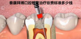 泰康拜博口腔根管治疗收费标准多少钱?根管治疗费用300-2300?