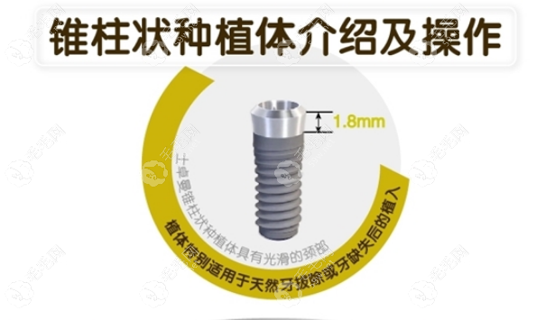 士卓曼种植体型号种类多 毛毛网