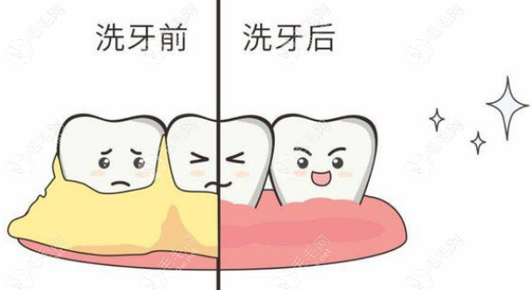 保定口腔医院洗牙价格：89元起一次