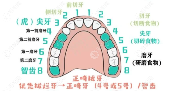 为什么正畸都是拔4号牙?拔4号牙和5号牙对脸型影响的区别