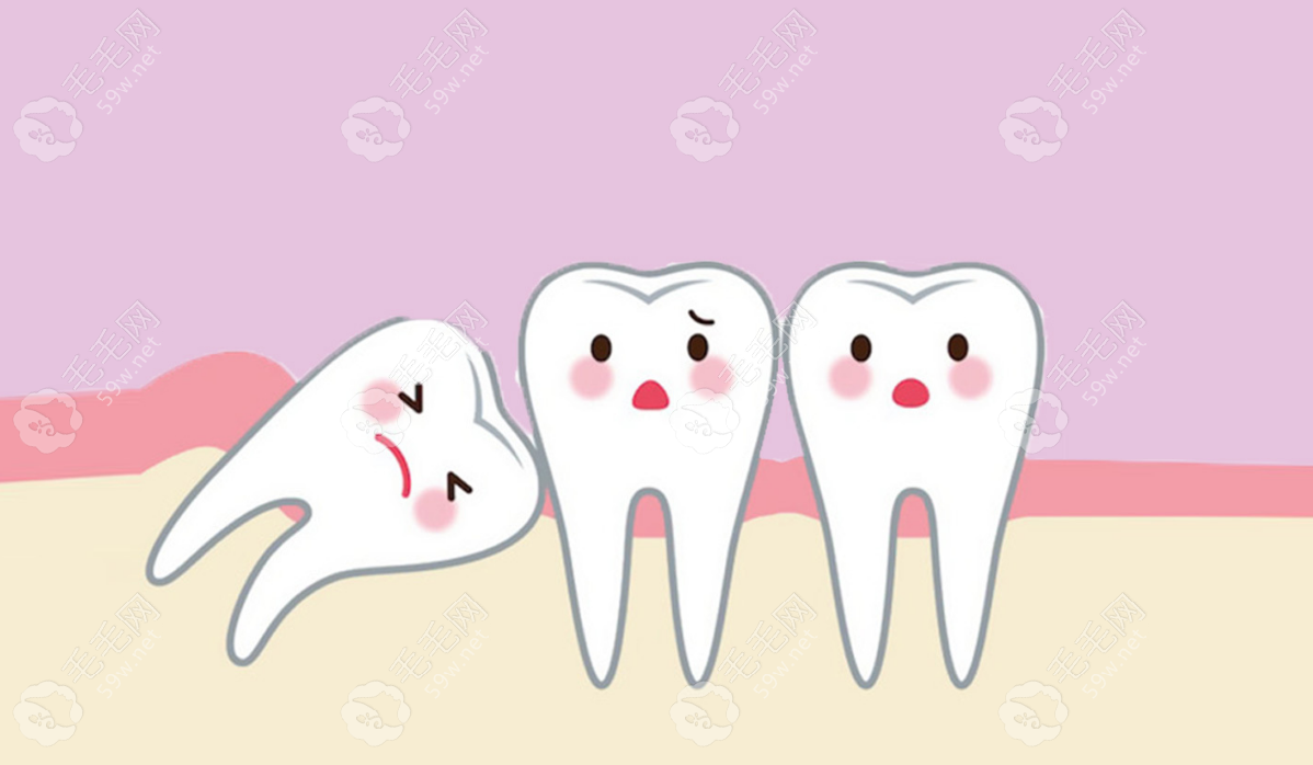 需要拔除智齿的情况毛毛网