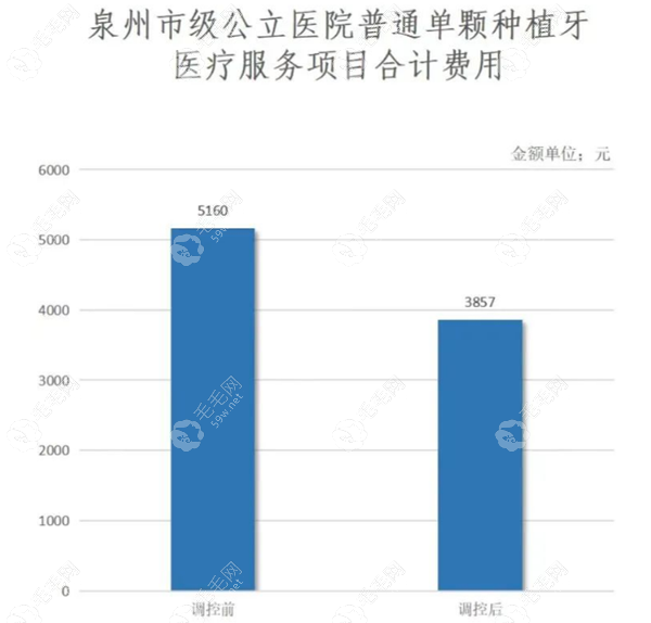 泉州种植牙价格表 59w.net