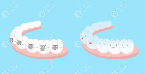 合肥牙齿矫正费用一览表www.59w.net