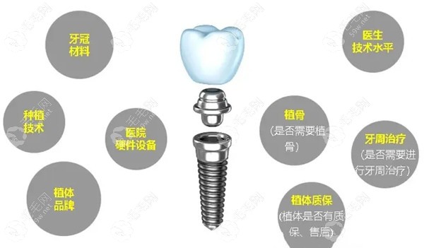 北京种植牙多少钱一颗2023年？2980-10000元左右一颗