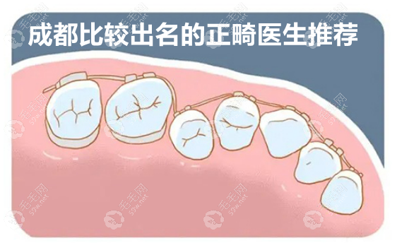 成都比较出名的正畸医生 毛毛网