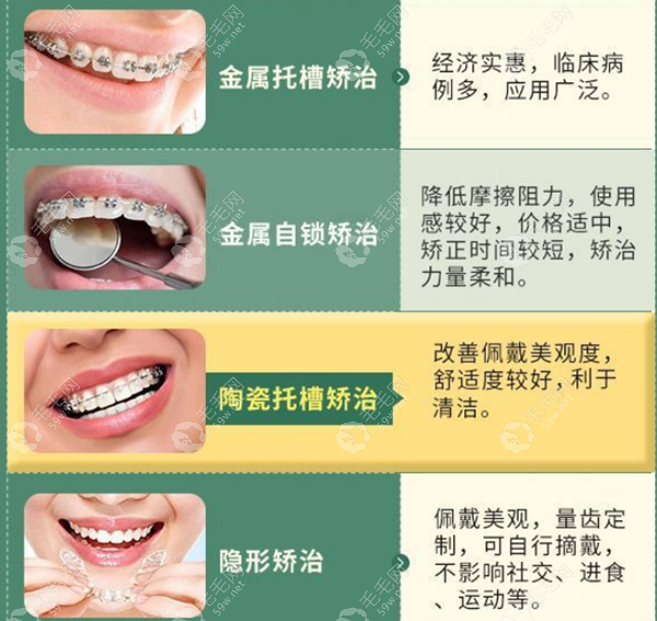 牙齿矫正的多种方式 毛毛网