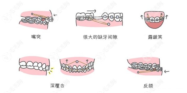 东莞厚街医院看牙贵不贵59w.net