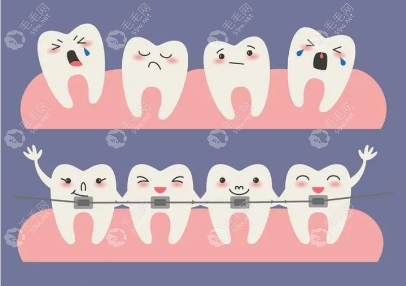 门牙牙缝大矫正大概要花费多少钱?成人整牙8k+/儿童整牙3k+
