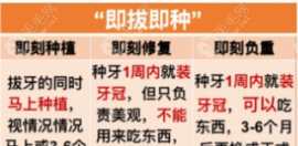 即拔即种植牙的利与弊解析:看即拔和拔牙三个月后种哪个好