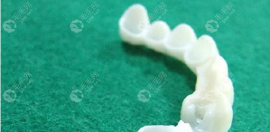 爱迪特氧化锆全瓷牙冠价格多少钱?与德国Vita全瓷牙比便宜些